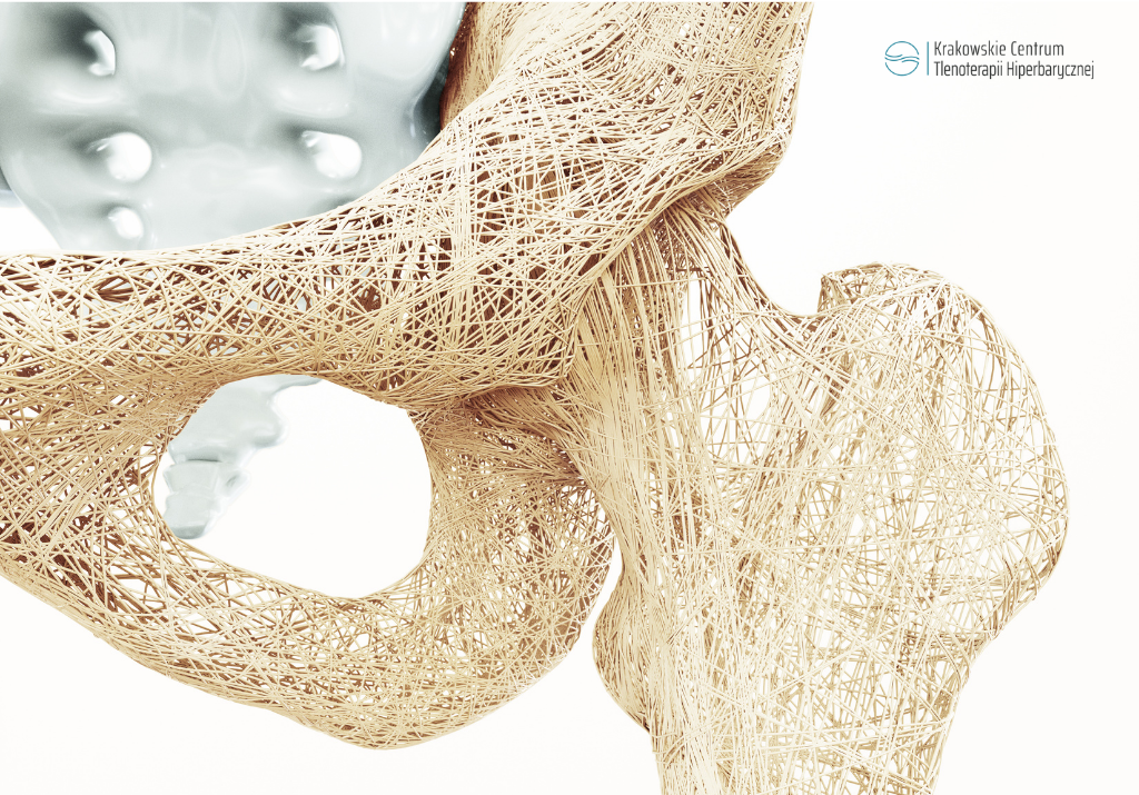 Osteoporoza – komora hiperbaryczna wsparciem w leczeniu.